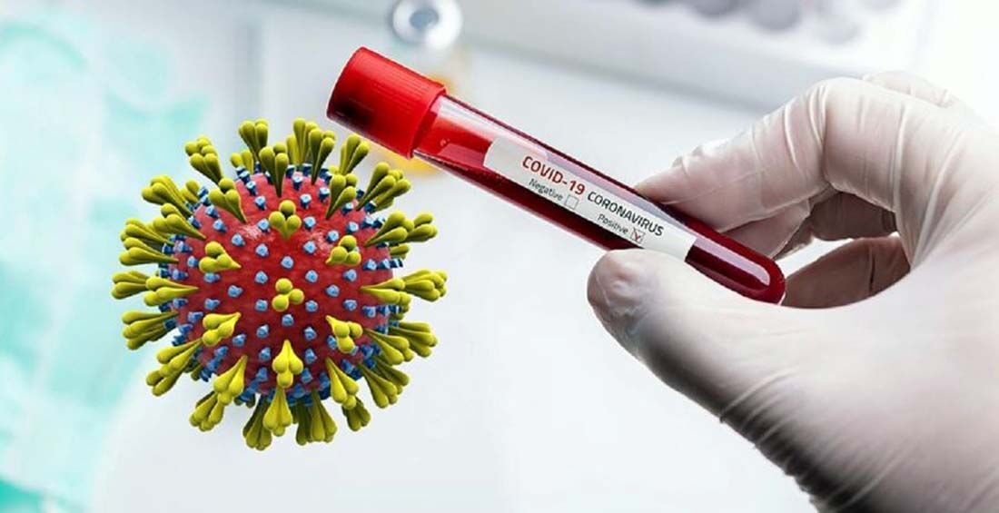 ह्वात्तै बढ्यो कोरोना सङ्क्रमितको ग्राफ, यी हुन् बढी संक्रमित रहेका जिल्लाहरु: