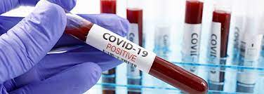 मकवानपुरमा पछिल्लो २४ घण्टामा थप १ सय २ जनामा कोरोना